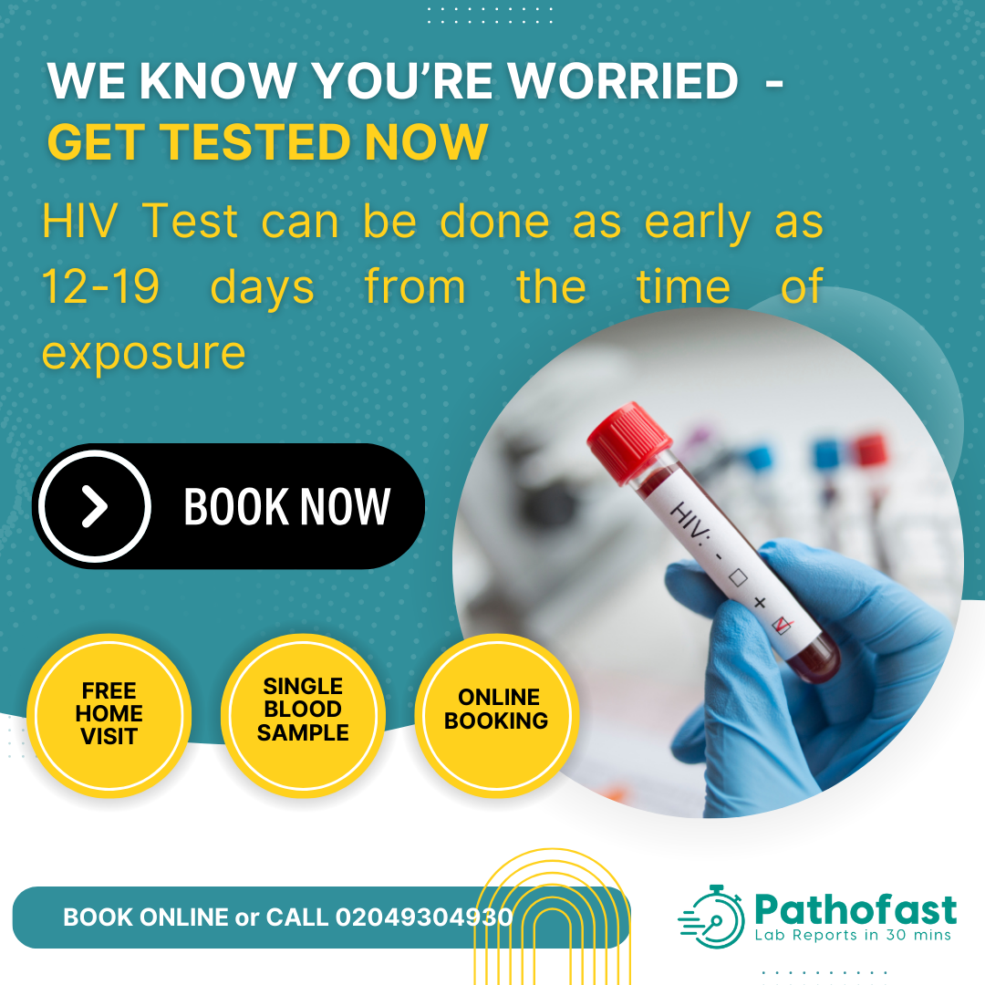HIV Test in Pune - How soon is it positive