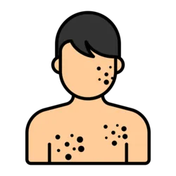 List of Tests for Skin rash