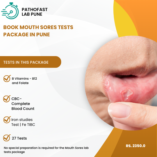 Book Mouth Sores Test Package in Pune Now