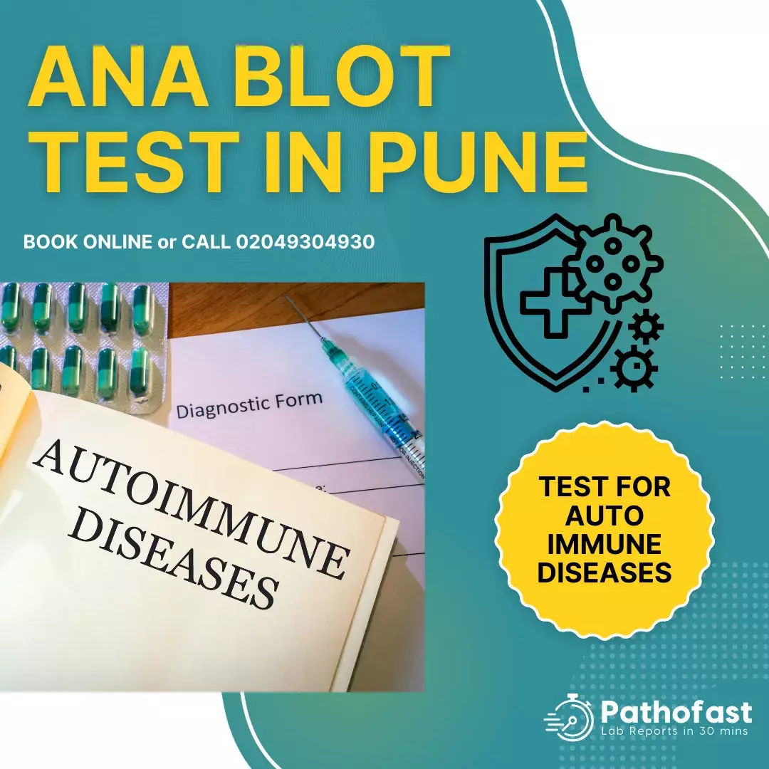 ANA Blot Test in Pune