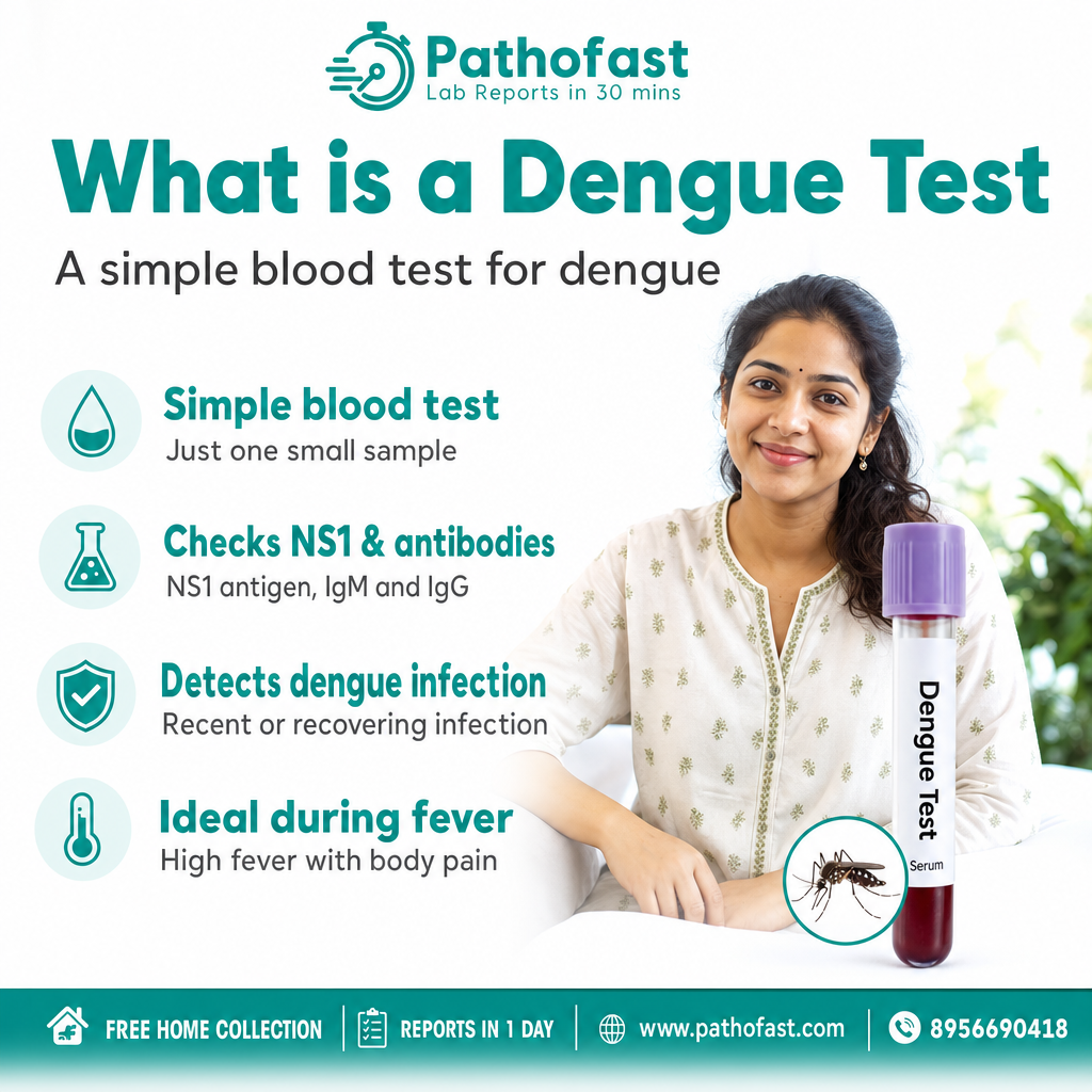 Dengue Test in Pune 