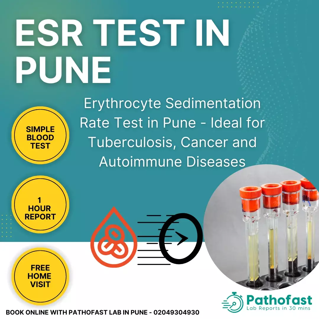 ESR Test in Pune - Erythrocyte Sedimentation Rate Test in Pune