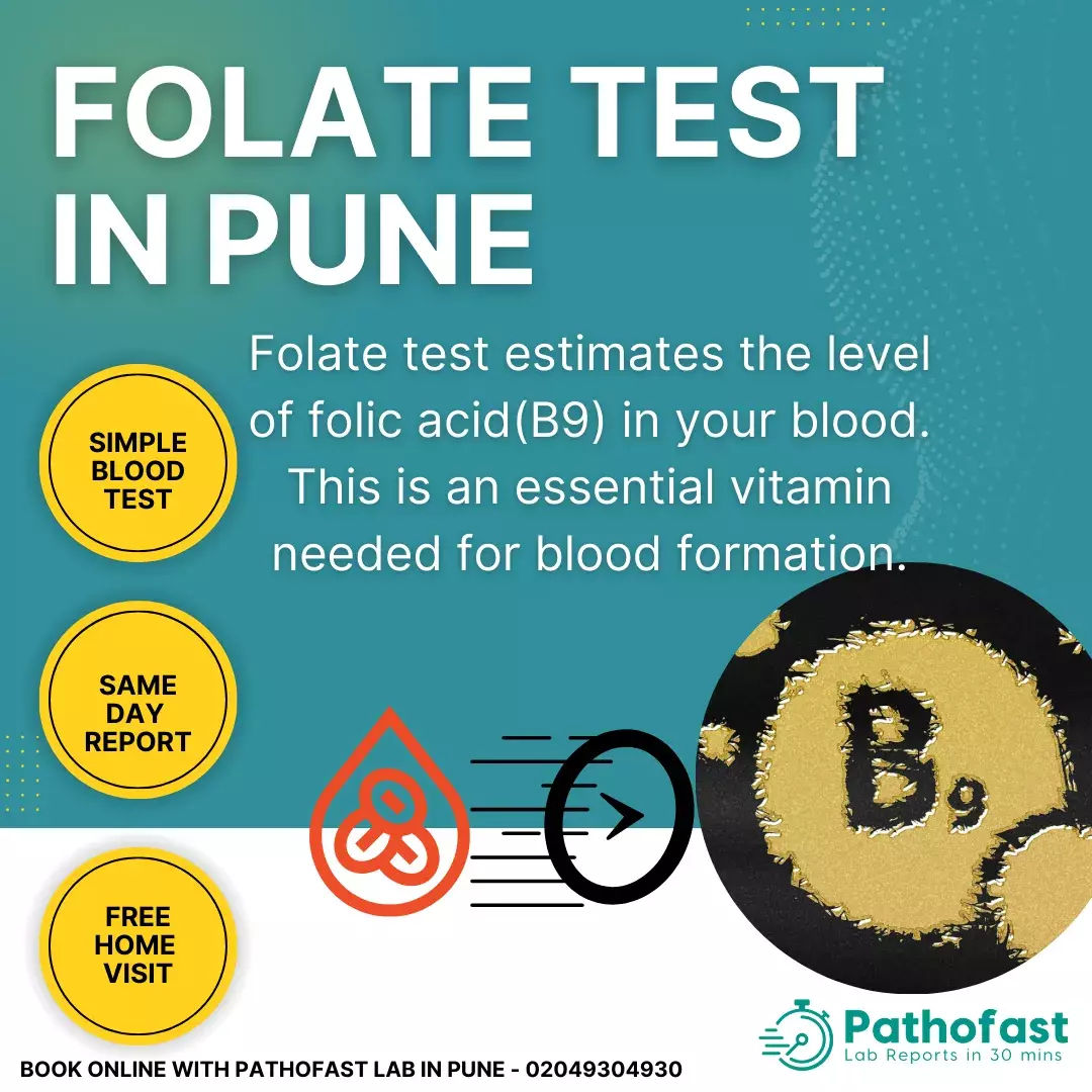 Folic Acid Test in Pune - Serum Folate Test