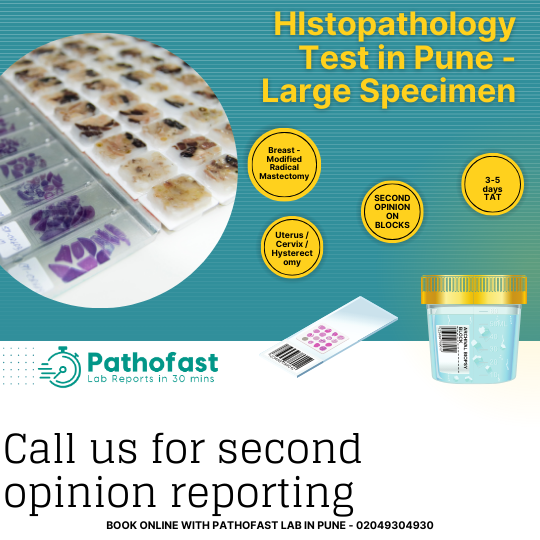Histopathology Test in Pune - Large Specimen Histopathology - Uterus, Breast, Mastectomy
