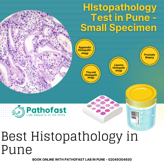 Histopathology Test in Pune - Small Specimen Histopathology