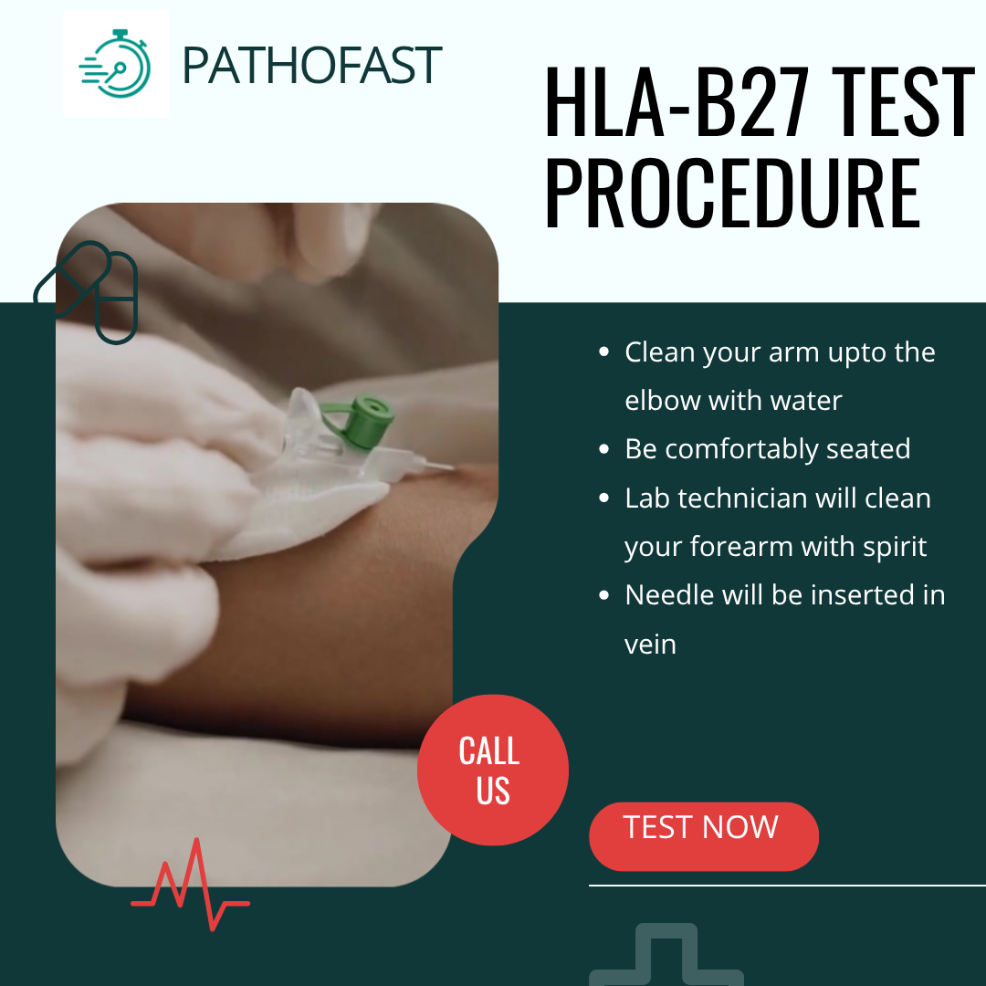 hla b27 test in Pune  : Book Now