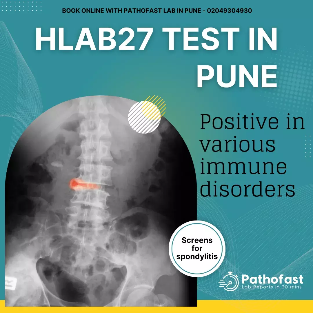HLAB27 Test in Pune