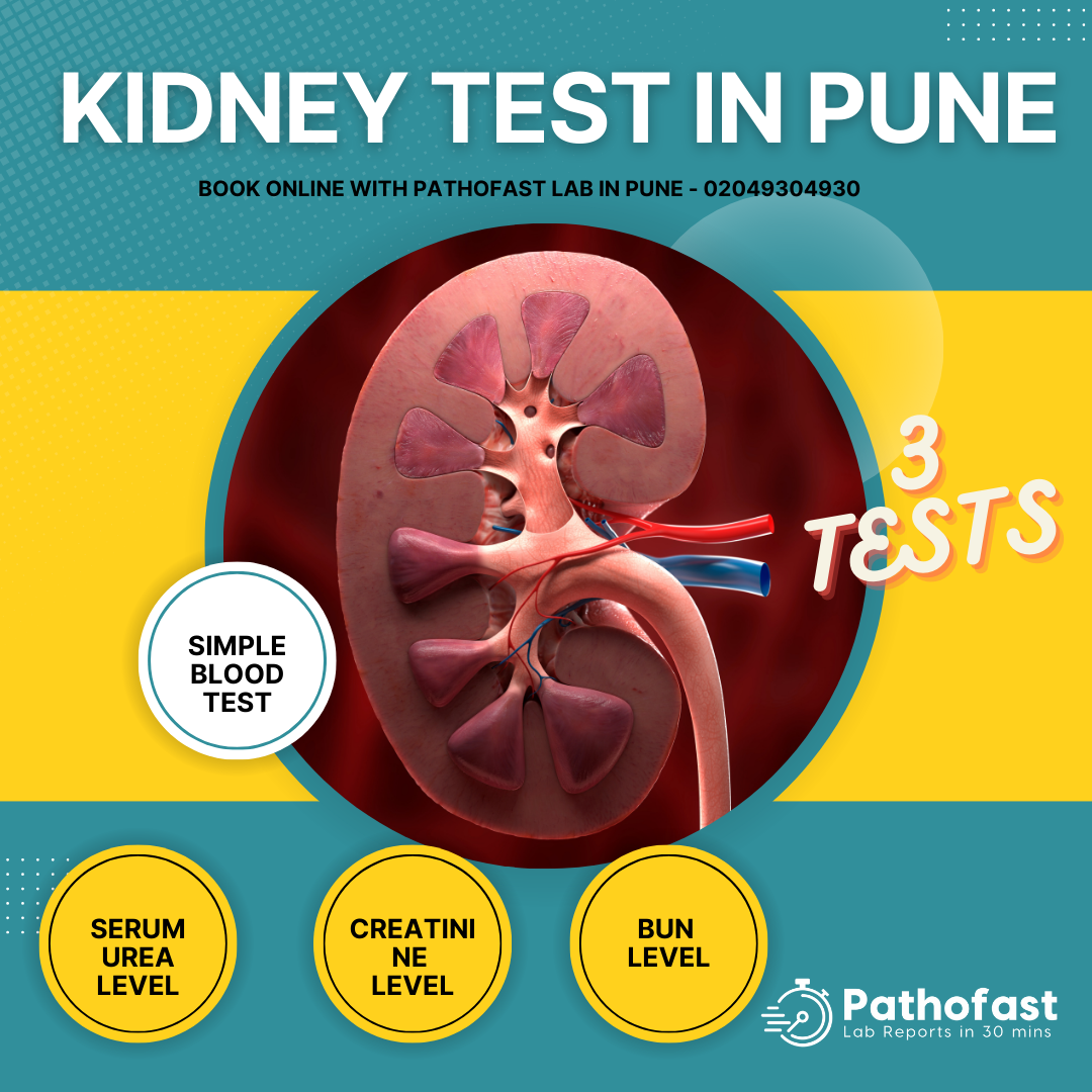 Kidney Test in Pune - Kidney Profile Test in Pune