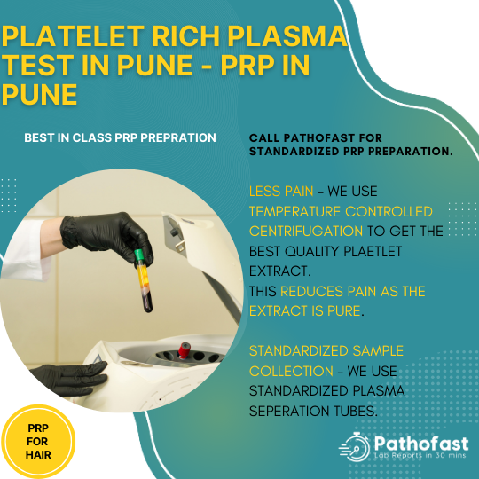 PRP Sample Extraction - Platelet RIch Plasma Test in Pune