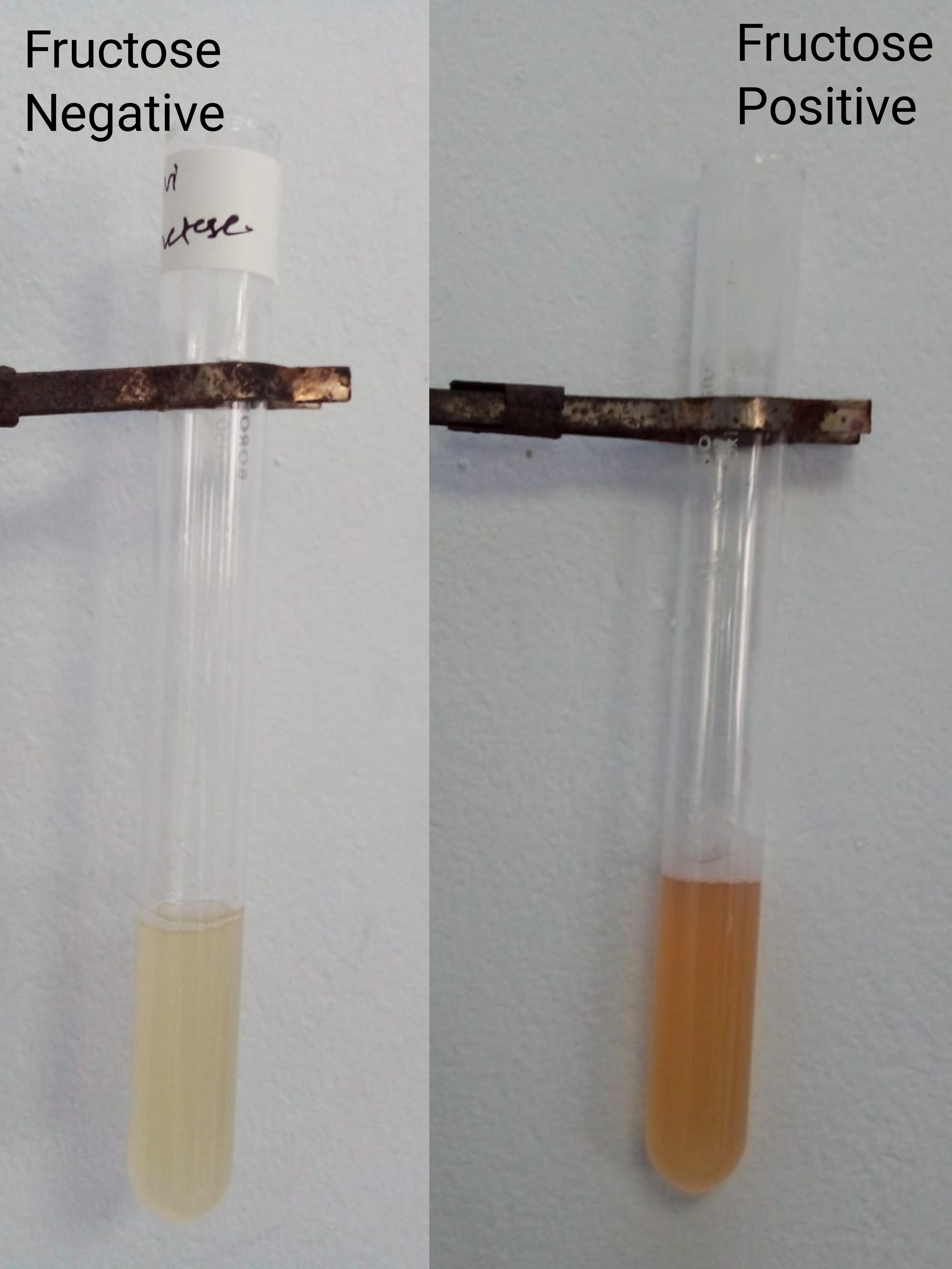 Semen Fructose Test : Seliwanoff Method - compare positive and negative result, fructose is absent in ejaculatory duct abnormalities (Image released in public domain)