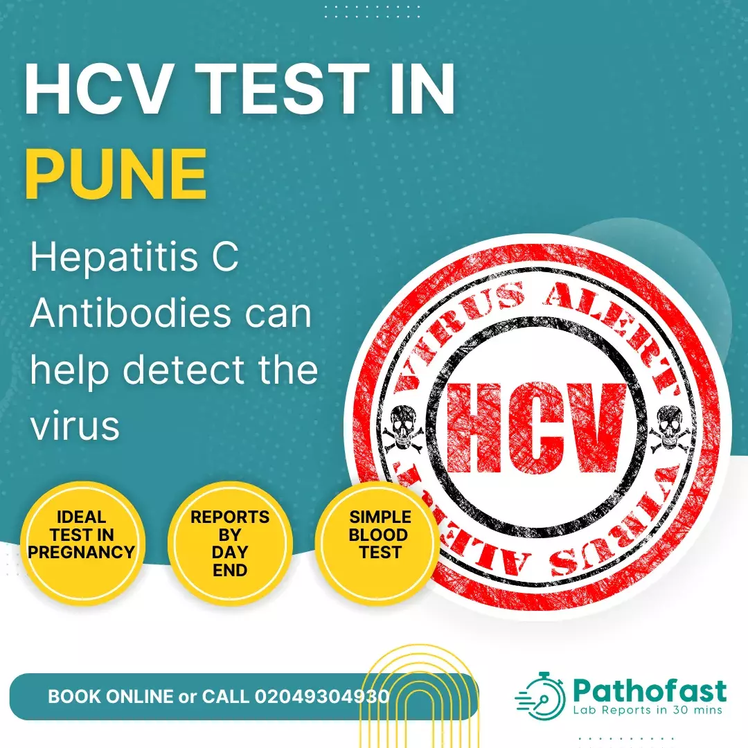 Hepatitis C Test in Pune - HCV Antibodies Test in Pune