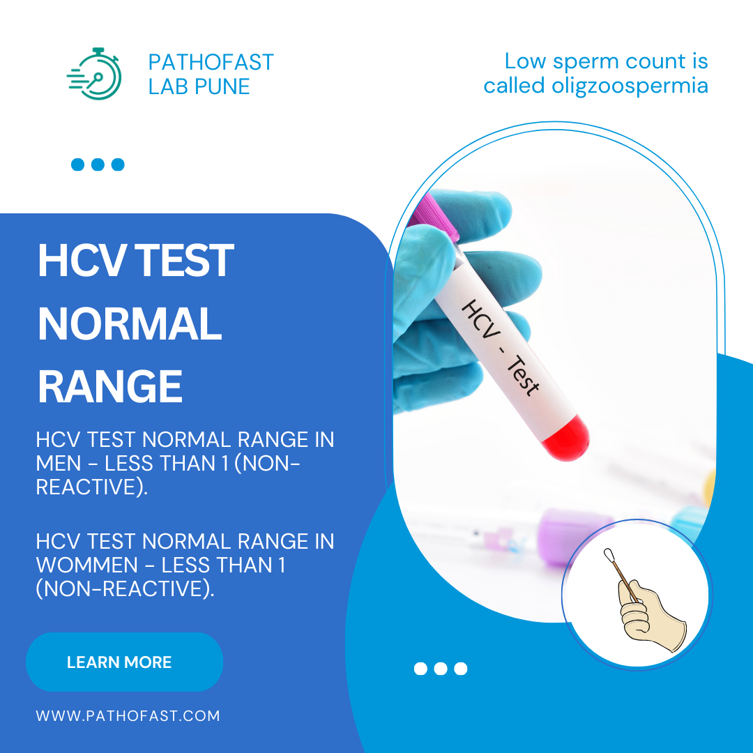 HCV Test in Pune Near Me Price Rs 1300 Total HCV Antibodies