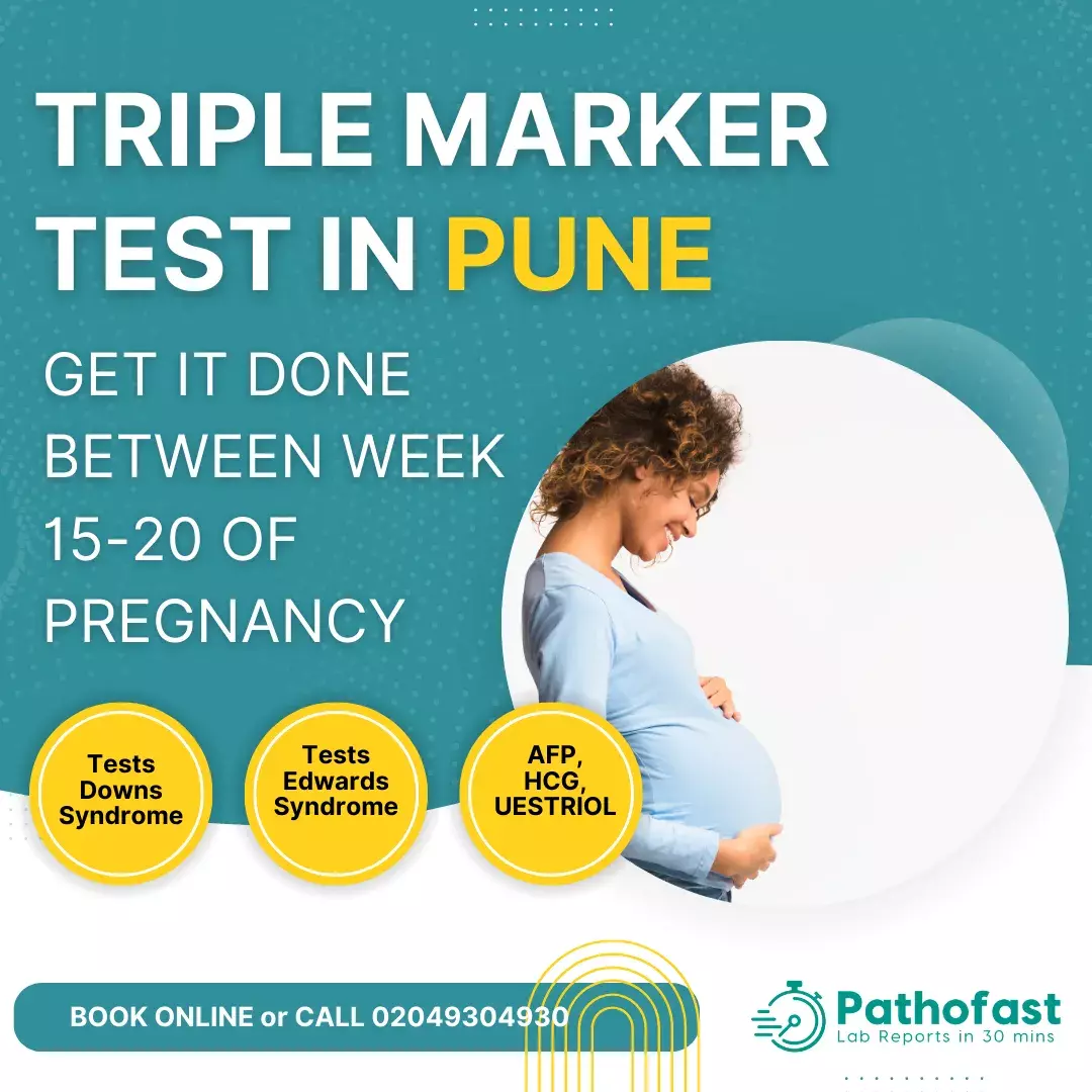 Triple Marker Test in Pune