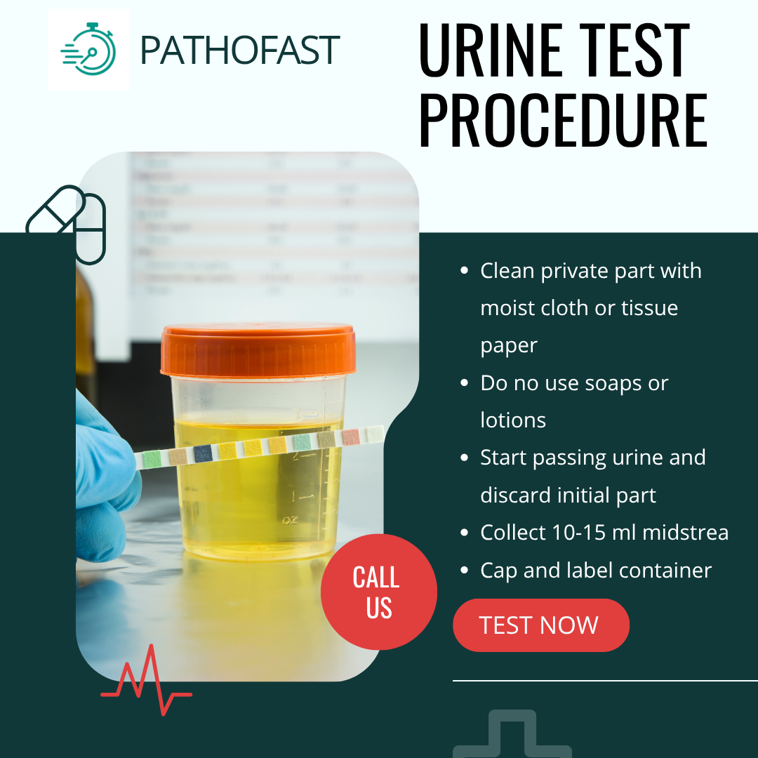 Urine Test Procedure | How to collect sample for urine test at home