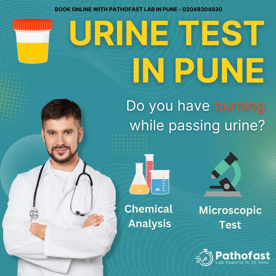 Urine Test in Pune - Routine Urine Test with Chemistry and Microscopy