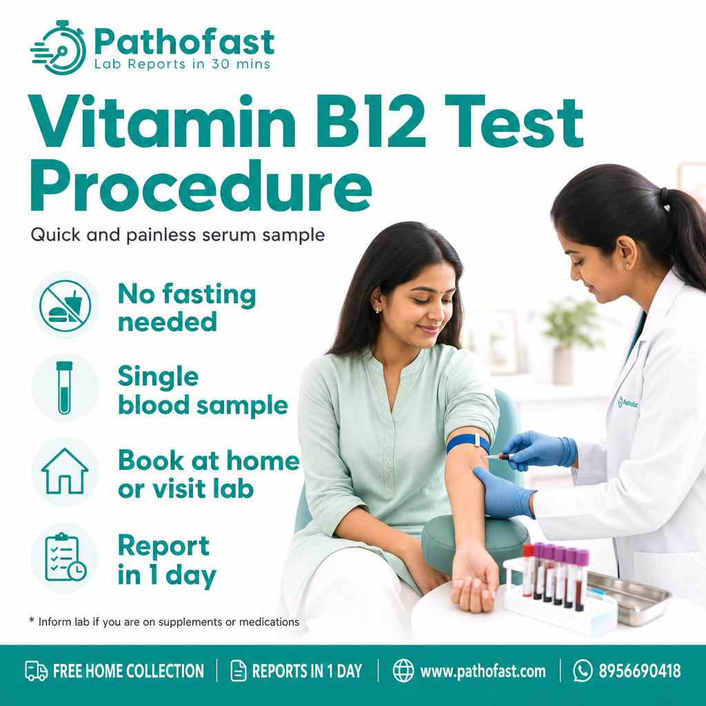 Vitamin B12 Test procedure - Pathofast Lab Pune