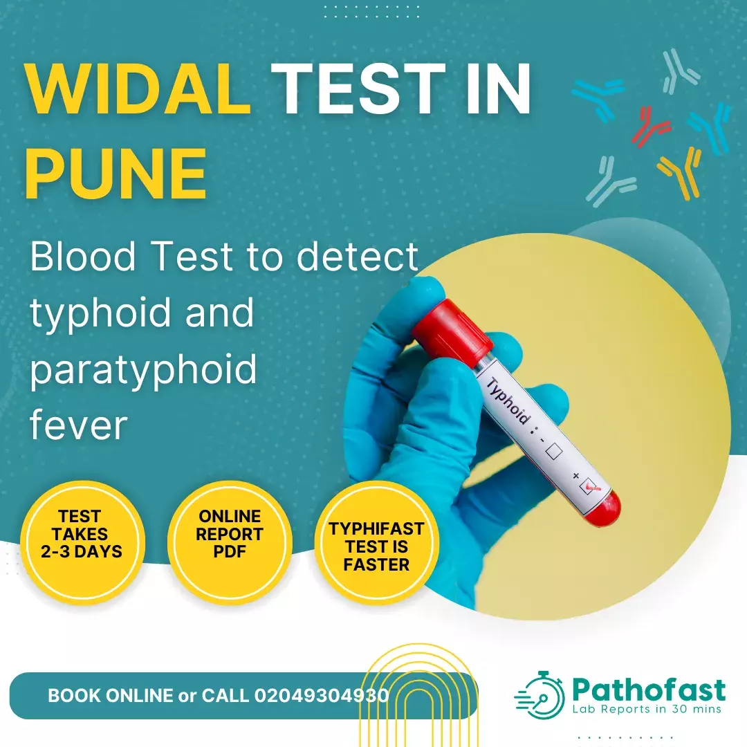 Widal Test in Pune