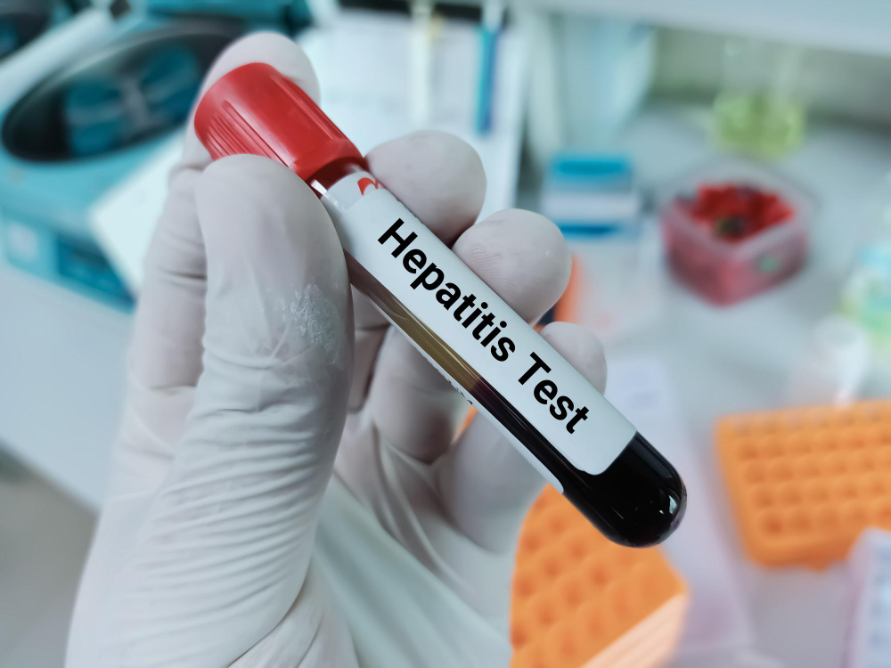 STD Testing Facilities