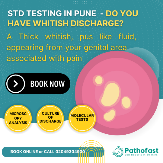 STD Tests for Discharge or Pus from Urethra