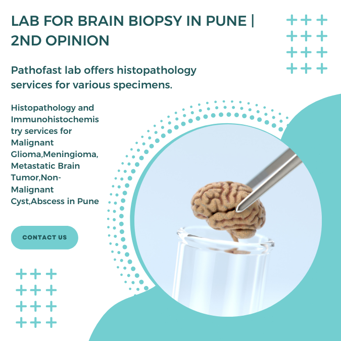 Lab for brain biopsy in Pune | 2nd Opinion for brain cancer