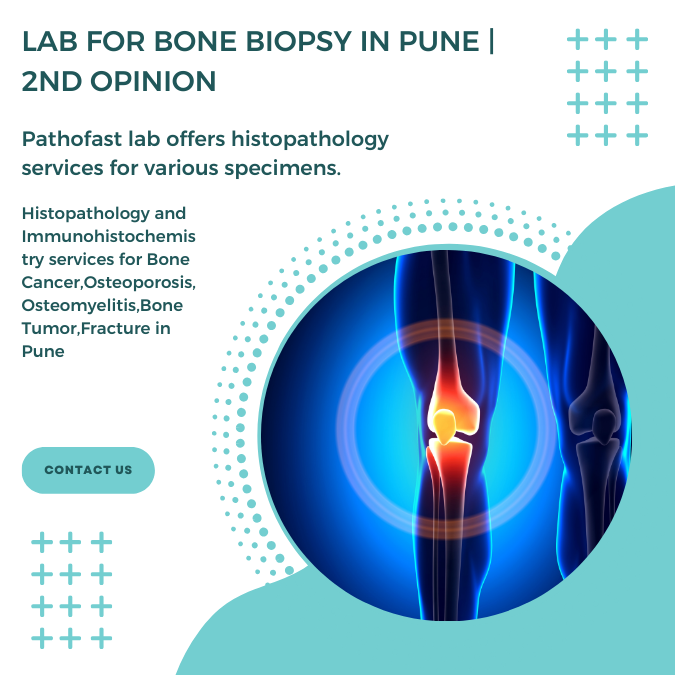 Lab for bone biopsy in Pune | 2nd Opinion for bone infection and cancers