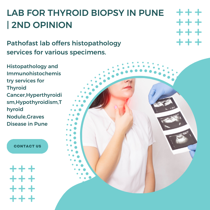 Lab for thyroid biopsy in Pune | 2nd Opinion for thyroid cancer