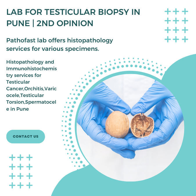 Lab for testicular biopsy in Pune | 2nd Opinion for testis cancer