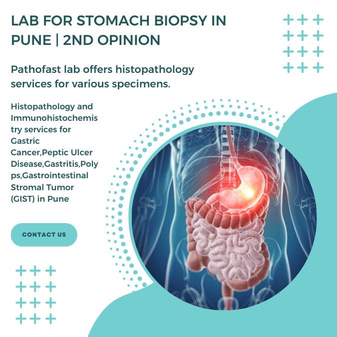 Lab for stomach biopsy in Pune | 2nd Opinion for stomach cancer and ulcers