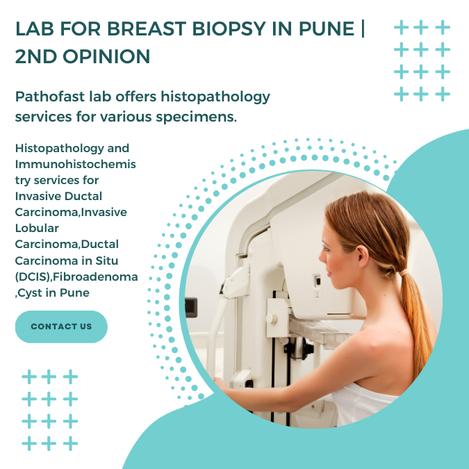 Lab for breast biopsy in Pune | 2nd Opinion for breast cancer