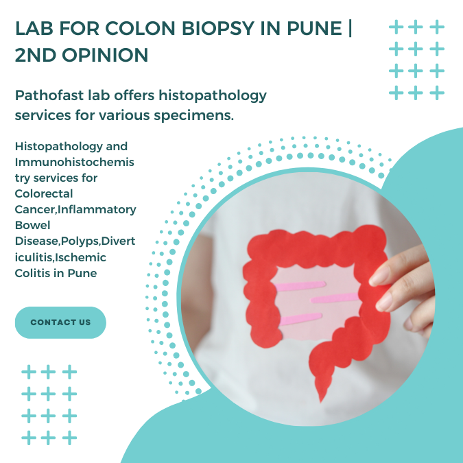 Lab for colon biopsy in Pune | 2nd Opinion for colon and rectal cancer