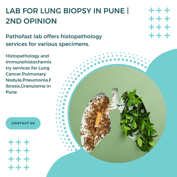 Lab for Lung Biopsy in Pune | Lung Biopsy Second Opinion Lab in Pune