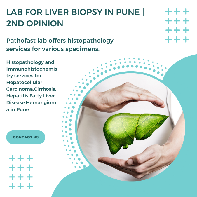 Lab for liver biopsy in Pune | 2nd Opinion for liver cancer and cirrhosis