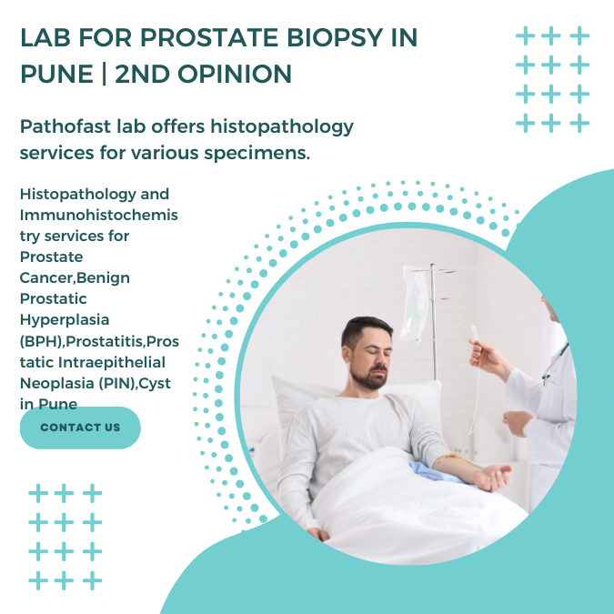Lab for prostate biopsy in Pune | 2nd Opinion for prostate cancer
