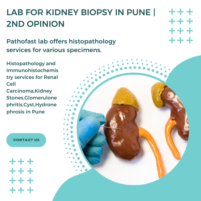 Lab for kidney biopsy in Pune | 2nd Opinion for kidney cancer and failure