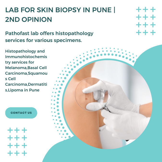 Lab for skin biopsy in Pune | 2nd Opinion for melanoma and fungal infections