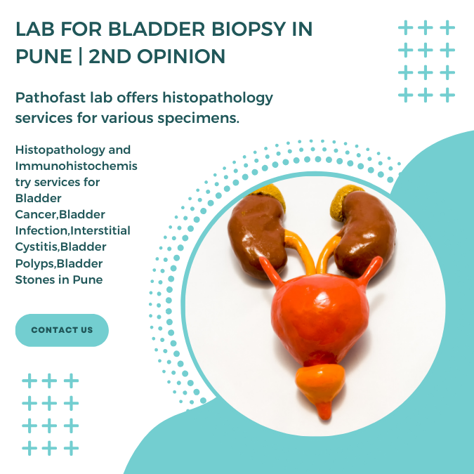 Lab for bladder biopsy in Pune | 2nd Opinion for bladder cancer and stones